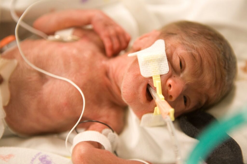 special needs adopiton